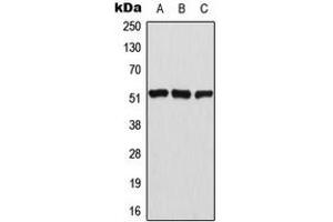 Western blot analysis of ATF2 (pT69) expression in HeLa (A), NIH3T3 (B), PC12 (C) whole cell lysates. (ATF2 antibody  (N-Term, pSer69))