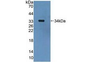 Detection of Recombinant MAP2K6, Human using Polyclonal Antibody to Mitogen Activated Protein Kinase Kinase 6 (MAP2K6) (MAP2K6 antibody  (AA 46-306))