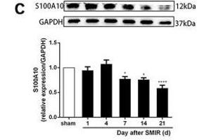 Astrocytes were activated and mainly expressed as the A1 phenotype in the spinal cord after SMIR. (GAPDH antibody)