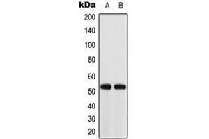Western blot analysis of ACOT2 expression in K562 (A), HT29 (B) whole cell lysates. (ACOT2 antibody  (Center))