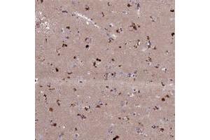 Immunohistochemical staining of human lateral ventricle with ADO polyclonal antibody  shows strong cytoplasmic positivity in neuronal cells. (ADO antibody)