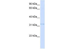 VDAC2 antibody used at 1 ug/ml to detect target protein. (VDAC2 antibody  (N-Term))