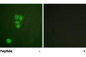 Immunofluorescence analysis of A-549 cells, using SOX9 polyclonal antibody . (SOX9 antibody  (Ser181))