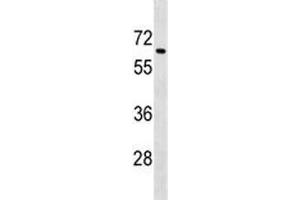 Tgfbr2 antibody western blot analysis in mouse spleen tissue lysate. (TGFBR2 antibody  (AA 548-575))