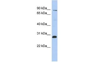 WB Suggested Anti-ZNF148 Antibody Titration:  0. (ZNF148 antibody  (Middle Region))