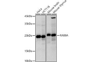 Western blot analysis of extracts of various cell lines, using RA antibody (ABIN7269814) at 1:1000 dilution. (RAB8A antibody)