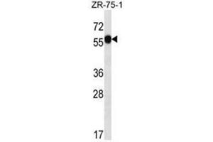 C6orf211 Antibody (N-term) western blot analysis in ZR-75-1 cell line lysates (35µg/lane). (C6ORF211 antibody  (N-Term))