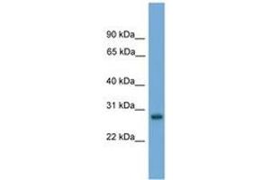 Image no. 1 for anti-Activator of Basal Transcription 1 (Abt1) (AA 171-220) antibody (ABIN6744581) (Activator of Basal Transcription 1 antibody  (AA 171-220))