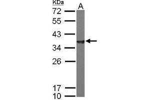 WB Image Sample (50 ug of whole cell lysate) A: mouse brain 12% SDS PAGE antibody diluted at 1:10000 (NAPA antibody  (Center))