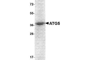 Western Blotting (WB) image for ATG5 Autophagy Related 5 (ATG5) (AA 1-275) protein (His tag) (ABIN2468251)