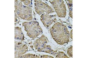 Immunohistochemistry of paraffin-embedded human stomach using CPOX antibody. (CPOX antibody  (AA 111-454))