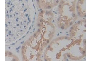 #VALUE! (P2RX7 antibody  (AA 47-334))