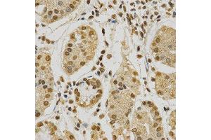Immunohistochemistry of paraffin-embedded human stomach using HNRNPA2B1 antibody at dilution of 1:200 (x400 lens).