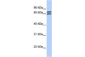 Western Blotting (WB) image for anti-DCP1 Decapping Enzyme Homolog B (DCP1B) antibody (ABIN2459448) (DCP1B antibody)
