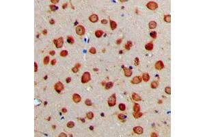 Immunohistochemical analysis of NXPH1 staining in human brain formalin fixed paraffin embedded tissue section. (Neurexophilin 1 antibody  (Center))