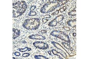 IHC analysis of MTA2 using anti-MTA2 antibody (ABIN7599519). (MTA2 antibody  (AA 1-668))