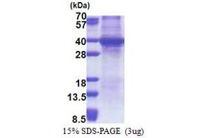 SDS-PAGE (SDS) image for Sprouty RTK Signaling Antagonist 4 (SPRY4) (AA 1-299) protein (His tag) (ABIN5853238) (SPRY4 Protein (AA 1-299) (His tag))