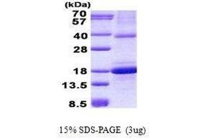 Figure annotation denotes ug of protein loaded and % gel used.