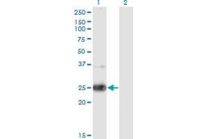 Western Blot analysis of NXPH3 expression in transfected 293T cell line by NXPH3 monoclonal antibody (M05), clone 4C8. (NXPH3 antibody  (AA 1-252))