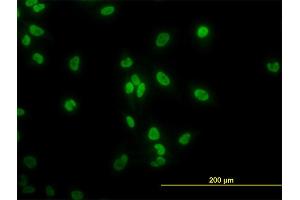 Immunofluorescence of monoclonal antibody to TAF11 on HeLa cell. (TAF11 antibody  (AA 158-210))
