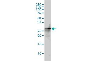 CDKN1B monoclonal antibody (M01), clone 4B4-E6 Western Blot analysis of CDKN1B expression in HL-60