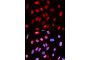 Immunofluorescence analysis of U2OS cells using RFC4 antibody. (RFC4 antibody  (AA 204-363))