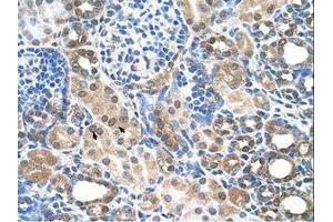 Image no. 1 for anti-Solute Carrier Family 22 (Organic Cation Transporter), Member 7 (SLC22A7) (C-Term) antibody (ABIN6736645) (SLC22A7 antibody  (C-Term))