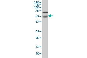 NOVA1 monoclonal antibody (M07), clone 3F3 Western Blot analysis of NOVA1 expression in IMR-32 . (NOVA1 antibody  (AA 408-507))