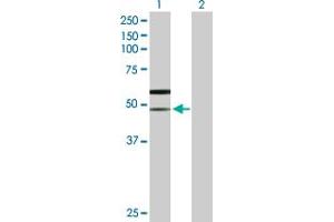 Western Blot analysis of SLC38A3 expression in transfected 293T cell line by SLC38A3 MaxPab polyclonal antibody. (SLC38A3 antibody  (AA 1-504))