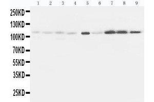Lane 9: HELA Cell Lysate (EPHA1 antibody  (C-Term))
