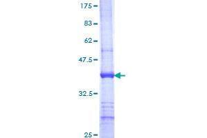 UGT1A9 Protein (AA 27-136) (GST tag)