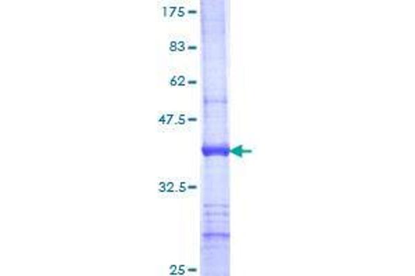 UGT1A9 Protein (AA 27-136) (GST tag)