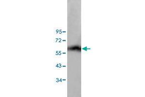 Western blot analysis of human lung tissue lysate with ANGPT4 polyclonal antibody  at 1:200 dilution.