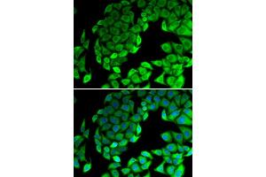 Immunofluorescence analysis of MCF7 cell using RPL14 antibody.