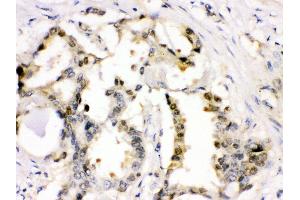 Immunohistochemistry (IHC) image for anti-Cyclin-Dependent Kinase 2 (CDK2) (AA 81-298) antibody (ABIN3043472)