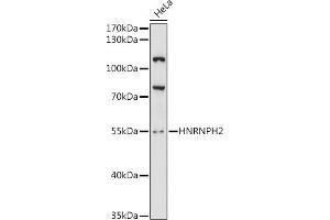 Western blot analysis of extracts of HeLa cells, using HNRNPH2 antibody (ABIN6132180, ABIN6141913, ABIN6141914 and ABIN6216812) at 1:3000 dilution. (HNRNPH2 antibody  (AA 210-285))