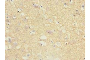 Immunohistochemistry of paraffin-embedded human brain tissue using ABIN7173721 at dilution of 1:100 (Tppp antibody  (AA 1-219))