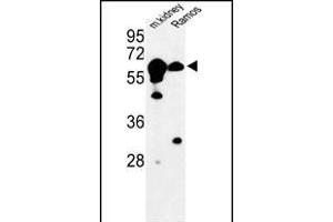 Western blot analysis of CBS Antibody (N-term) (ABIN1881141 and ABIN2841140) in mouse kidney tissue and Ramos cell line lysates (35 μg/lane). (CBS antibody  (N-Term))