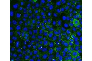 IF analysis of ITGB4 using anti-ITGB4 antibody (ABIN7601134).