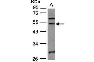 WB Image Sample(30 ug whole cell lysate) A:293T 10% SDS PAGE antibody diluted at 1:1000 (NSUN6 antibody  (Center))