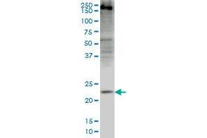 CRYGD monoclonal antibody (M03), clone 4E12 Western Blot analysis of CRYGD expression in HepG2 . (CRYGD antibody  (AA 75-174))