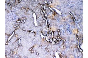 IHC analysis of VEGF Receptor 2 using anti-VEGF Receptor 2 antibody . (VEGFR2/CD309 antibody  (AA 20-244))
