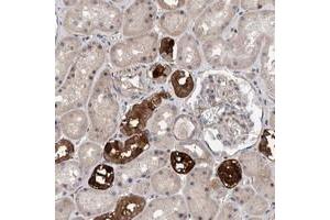 Immunohistochemical staining of human kidney with SLC45A4 polyclonal antibody  shows strong cytoplasmic positivity in subsets of renal tubules. (SLC45A4 antibody)