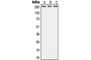 Western blot analysis of ABCA1 expression in A549 (A), Raw264. (ABCA1 antibody  (Center))