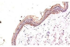 Immunohistochemistry of paraffin-embedded Human skin tissue with Phospho-MLKL (Ser358) Monoclonal Antibody at dilution of 1:200 (MLKL antibody  (pSer358))