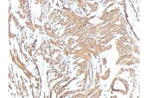Immunohistochemistry (Formalin-fixed Paraffin-embedded Sections) (IHC (fp)) image for anti-Actin, alpha 2, Smooth Muscle, Aorta (ACTA2) (N-Term) antibody (ABIN3024120)