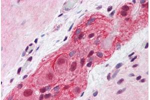 Human Small Intestine, Myenteric Plexus: Formalin-Fixed, Paraffin-Embedded (FFPE) (MED17 antibody  (AA 551-652))