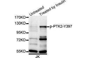 Western blot analysis of extracts of Jurkat cell line, using Phospho-PTK2-Y397 antibody. (FAK antibody  (pTyr397))