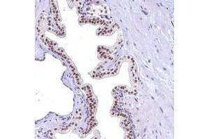Immunohistochemical staining of human prostate with FLYWCH2 polyclonal antibody  shows moderate nuclear positivity in glandular cells at 1:50-1:200 dilution. (FLYWCH2 antibody)