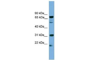WB Suggested Anti-SLC6A3 Antibody Titration:  0. (SLC6A3 antibody  (N-Term))